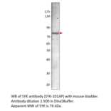 Anti-Syk Antibody from FabGennix (SYK-101AP) - Antibodies.com