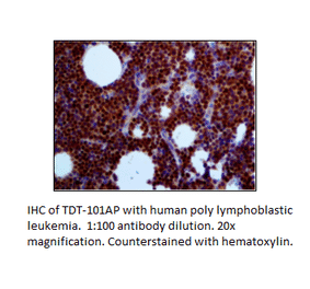 Anti-TdT Antibody from FabGennix (TDT-101AP) - Antibodies.com