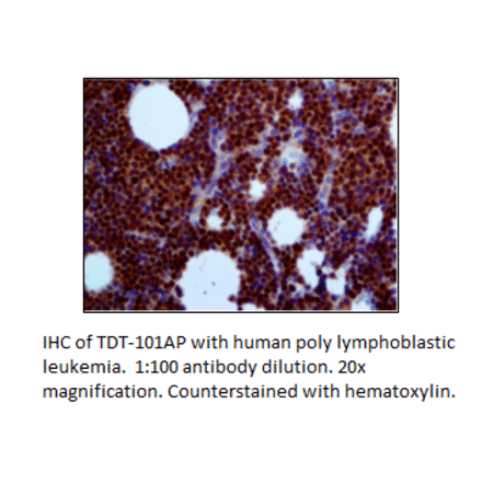 Anti-TdT Antibody from FabGennix (TDT-101AP) - Antibodies.com