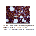 Anti-TdT Antibody from FabGennix (TDT-101AP) - Antibodies.com