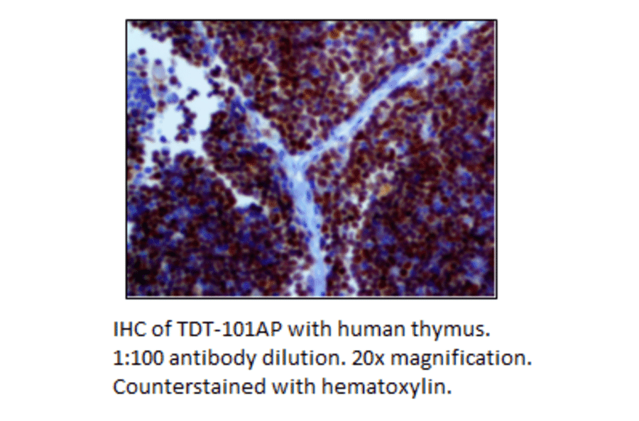 Anti-TdT Antibody from FabGennix (TDT-101AP) - Antibodies.com
