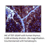 Anti-TdT Antibody from FabGennix (TDT-101AP) - Antibodies.com