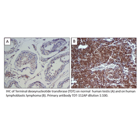 Anti-TdT Antibody from FabGennix (TDT-112AP) - Antibodies.com