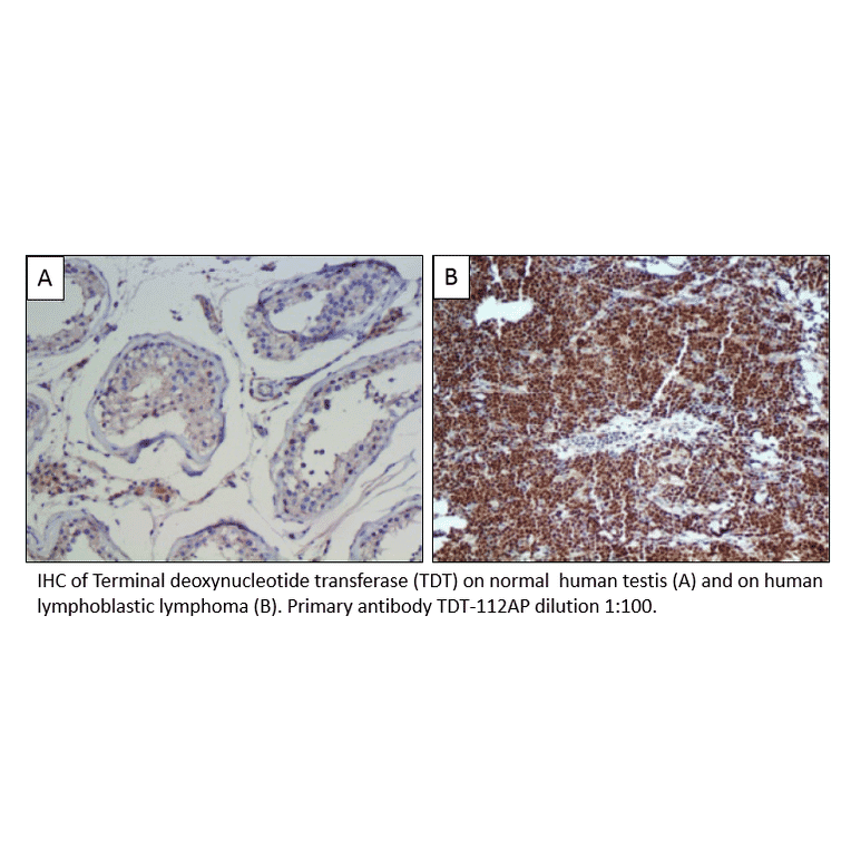 Anti-TdT Antibody from FabGennix (TDT-112AP) - Antibodies.com