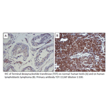 Anti-TdT Antibody from FabGennix (TDT-112AP) - Antibodies.com