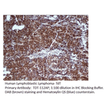 Anti-TdT Antibody from FabGennix (TDT-112AP) - Antibodies.com