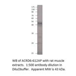Atypical Chemokine Receptor D6 Blocking Peptide from FabGennix (P-ACRD6H) - Antibodies.com
