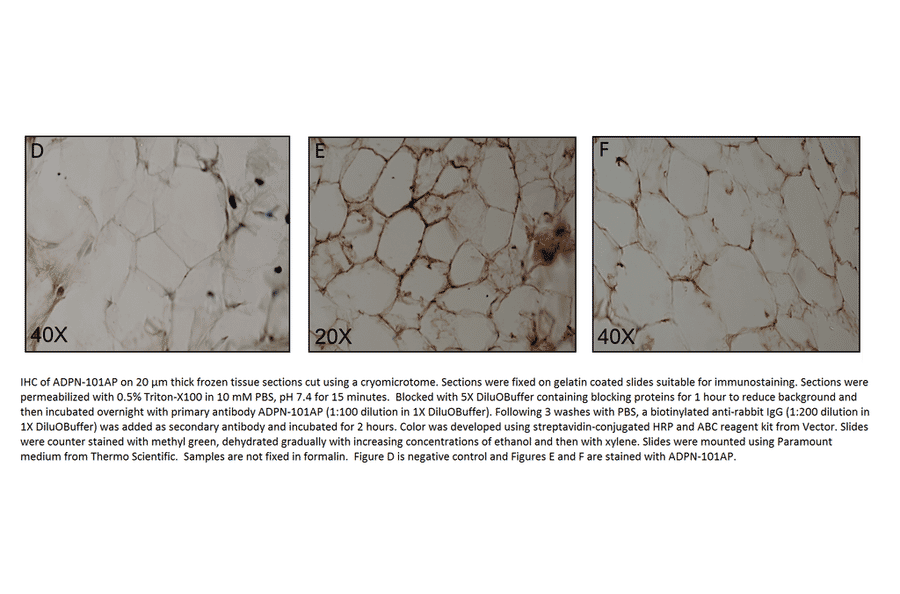 Adiponectin Blocking Peptide from FabGennix (P-ADPN) - Antibodies.com