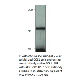 ACK1 Blocking Peptide from FabGennix (P-ACK1) - Antibodies.com