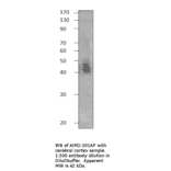 AIM2 Blocking Peptide from FabGennix (P-AIM2) - Antibodies.com