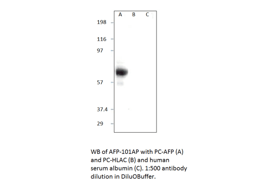 Alpha 1 Fetoprotein Positive Control from FabGennix (PC-AFP) - Antibodies.com