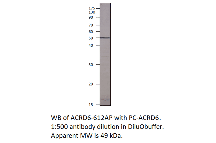 Atypical Chemokine Receptor D6 Positive Control from FabGennix (PC-ACRD6) - Antibodies.com