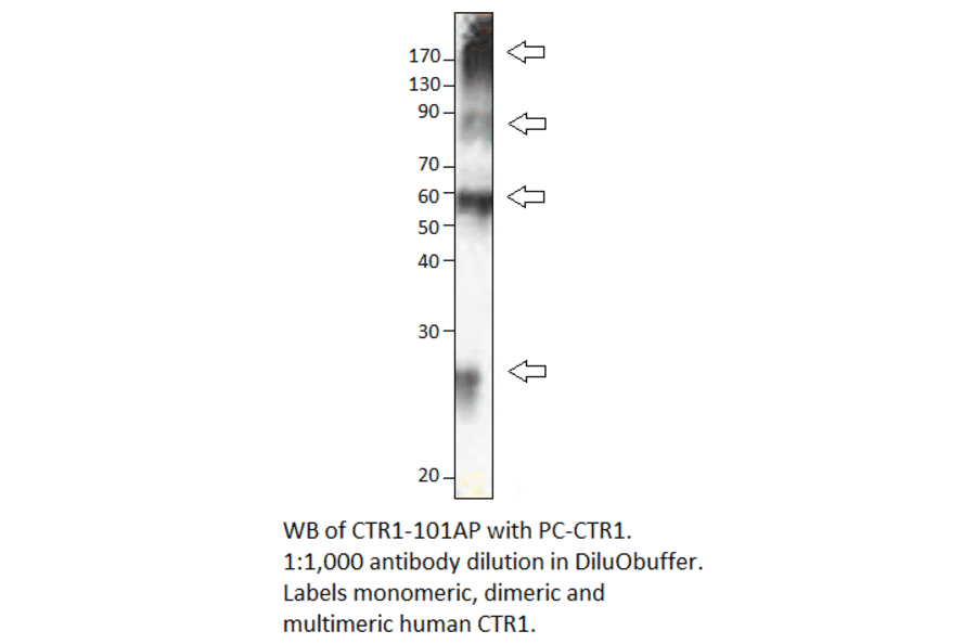 CTR1 / SLC31A1 Positive Control from FabGennix (PC-CTR1) - Antibodies.com