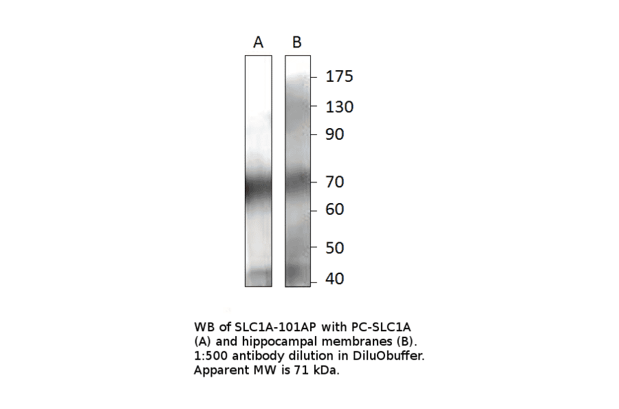 Anti-EAAT2 Antibody Positve Control from FabGennix (PC-SLC1A) - Antibodies.com