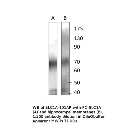 Anti-EAAT2 Antibody Positve Control from FabGennix (PC-SLC1A) - Antibodies.com