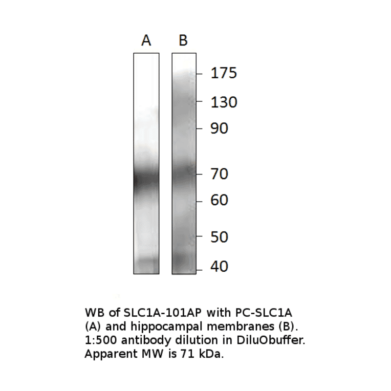 Anti-EAAT2 Antibody Positve Control from FabGennix (PC-SLC1A) - Antibodies.com