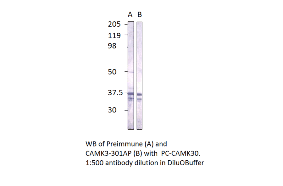 CaMKII gamma Positive Control from FabGennix (PC-CAMK3) - Antibodies.com
