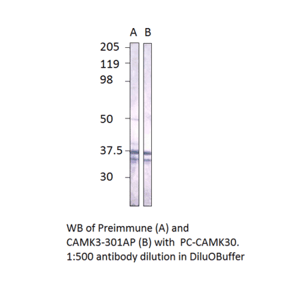 CaMKII gamma Positive Control from FabGennix (PC-CAMK3) - Antibodies.com