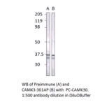 CaMKII gamma Positive Control from FabGennix (PC-CAMK3) - Antibodies.com
