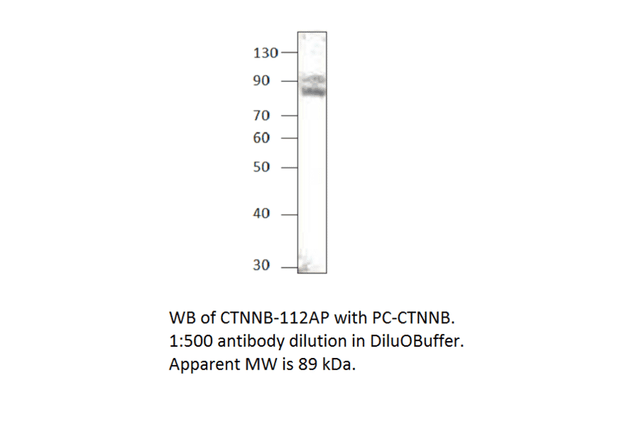 beta Catenin Positive Control from FabGennix (PC-CTNNB) - Antibodies.com