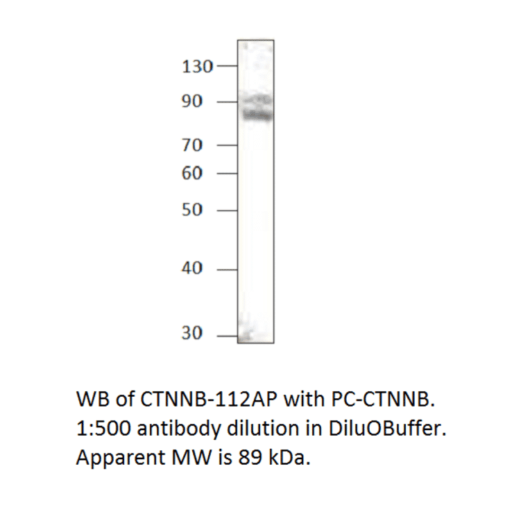 beta Catenin Positive Control from FabGennix (PC-CTNNB) - Antibodies.com