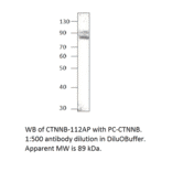 beta Catenin Positive Control from FabGennix (PC-CTNNB) - Antibodies.com