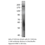 Topoisomerase II alpha Positive Control from FabGennix (PC-TOPO2A) - Antibodies.com