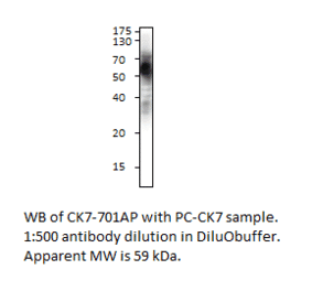 Cytokeratin 7 Positive Control from FabGennix (PC-CK7) - Antibodies.com