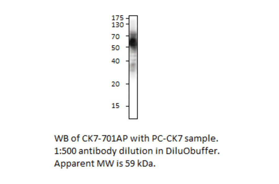 Cytokeratin 7 Positive Control from FabGennix (PC-CK7) - Antibodies.com