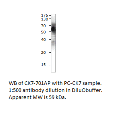 Cytokeratin 7 Positive Control from FabGennix (PC-CK7) - Antibodies.com