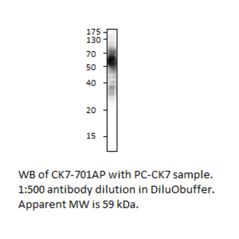Cytokeratin 7 Positive Control from FabGennix (PC-CK7) - Antibodies.com