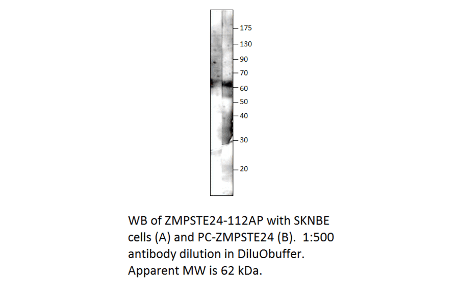 ZMPSTE24 Positive Control from FabGennix (PC-ZMPSTE24) - Antibodies.com