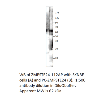 ZMPSTE24 Positive Control from FabGennix (PC-ZMPSTE24) - Antibodies.com