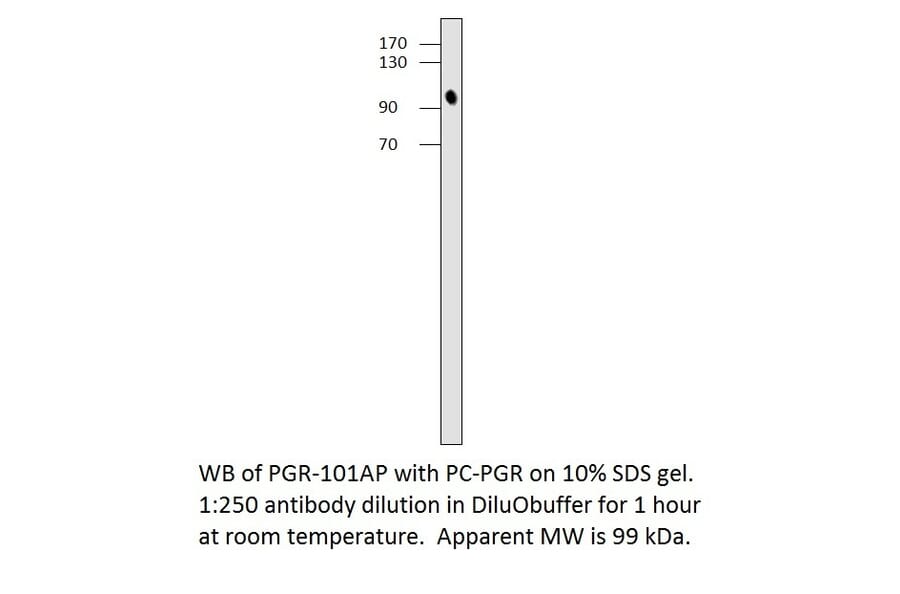 Progesterone Receptor Positive Control from FabGennix (PC-PGR) - Antibodies.com