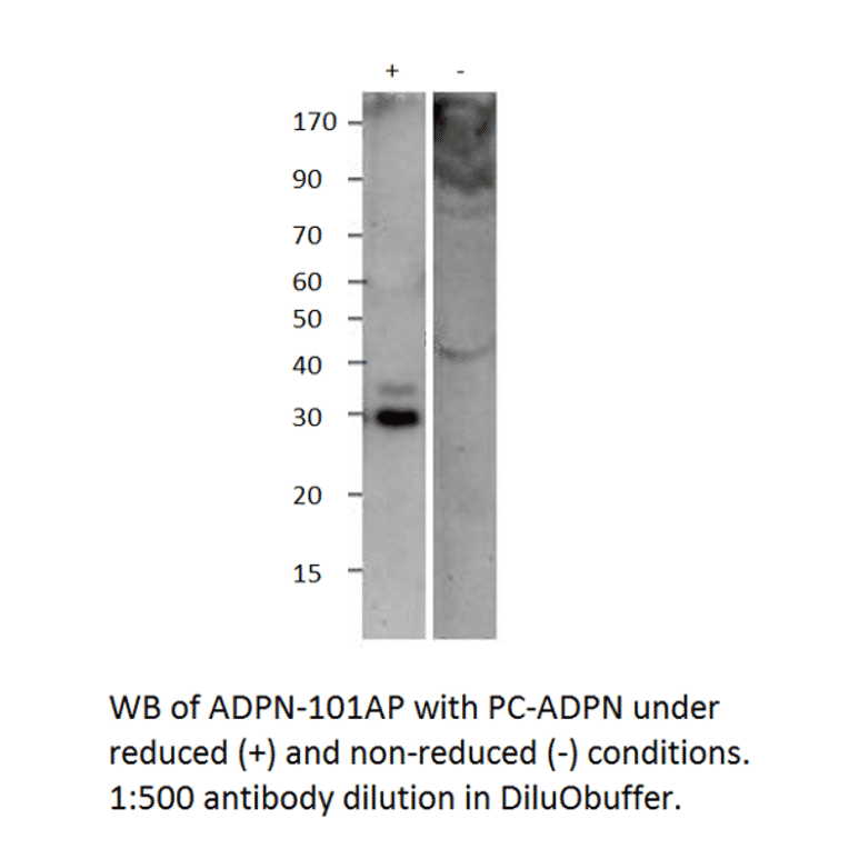 Adiponectin Positive Control from FabGennix (PC-ADPN) - Antibodies.com