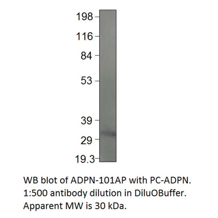 Adiponectin Positive Control from FabGennix (PC-ADPN) - Antibodies.com