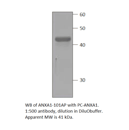 Annexin A1 Positive Control from FabGennix (PC-ANXA1) - Antibodies.com