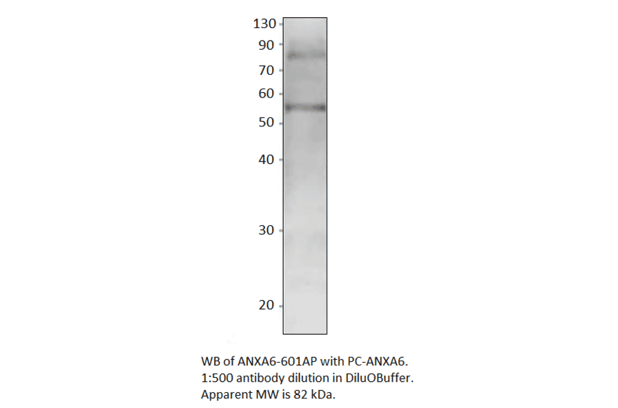 Annexin A6 Positive Control from FabGennix (PC-ANXA6) - Antibodies.com