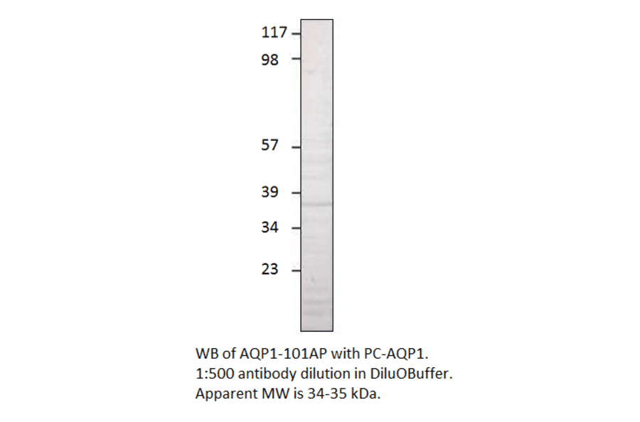 Aquaporin 1 Positive Control from FabGennix (PC-AQP1) - Antibodies.com