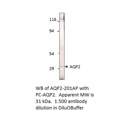 Aquaporin 2 Positive Control from FabGennix (PC-AQP2) - Antibodies.com