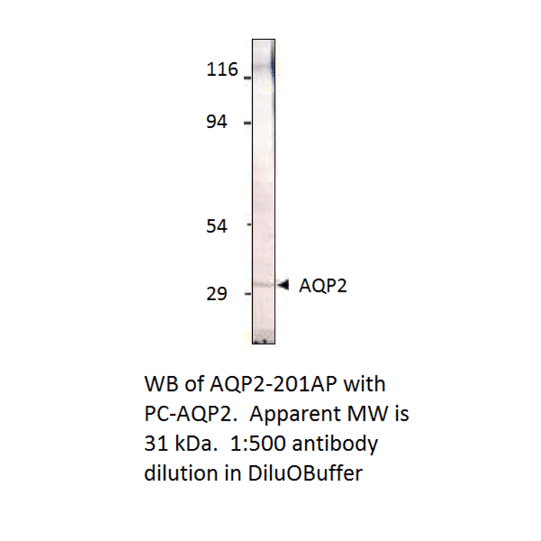 Aquaporin 2 Positive Control from FabGennix (PC-AQP2) - Antibodies.com