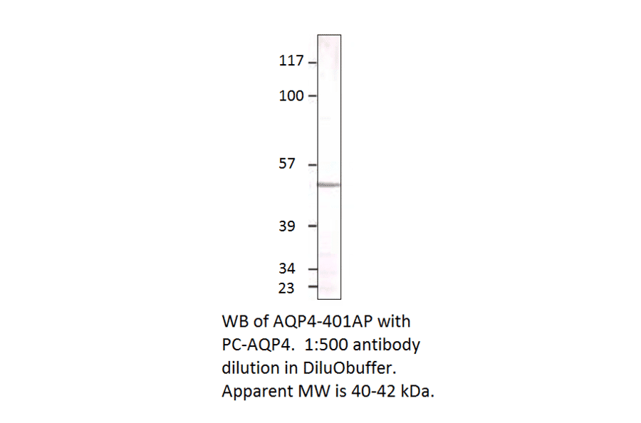 Aquaporin 4 Positive Control from FabGennix (PC-AQP4) - Antibodies.com