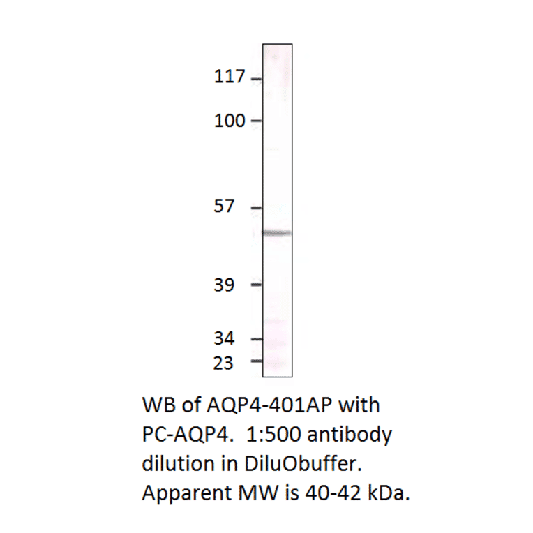 Aquaporin 4 Positive Control from FabGennix (PC-AQP4) - Antibodies.com