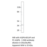 Aquaporin 6 Positive Control from FabGennix (PC-AQP6) - Antibodies.com