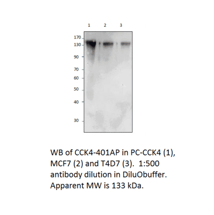 CCK4 / PTK7 Positive Control from FabGennix (PC-CCK4) - Antibodies.com