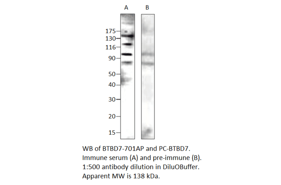 BTB/POZ domain-containing protein 7 Positive Control from FabGennix (PC-BTBD7) - Antibodies.com