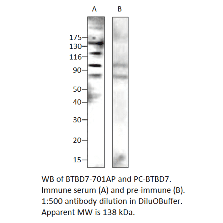 BTB/POZ domain-containing protein 7 Positive Control from FabGennix (PC-BTBD7) - Antibodies.com