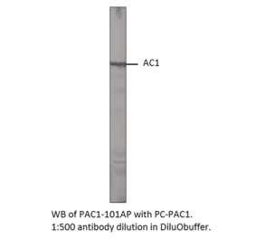 Adenylate cyclase 1 Positive Control from FabGennix (PC-PAC1) - Antibodies.com