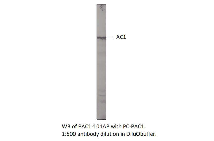 Adenylate cyclase 1 Positive Control from FabGennix (PC-PAC1) - Antibodies.com