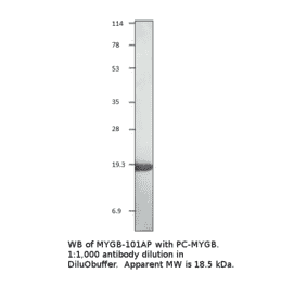 Myoglobin Positive Control from FabGennix (PC-MYGB) - Antibodies.com